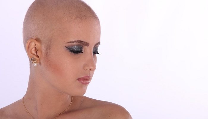 Dreams about Going Bald – Meaning and Symbolism